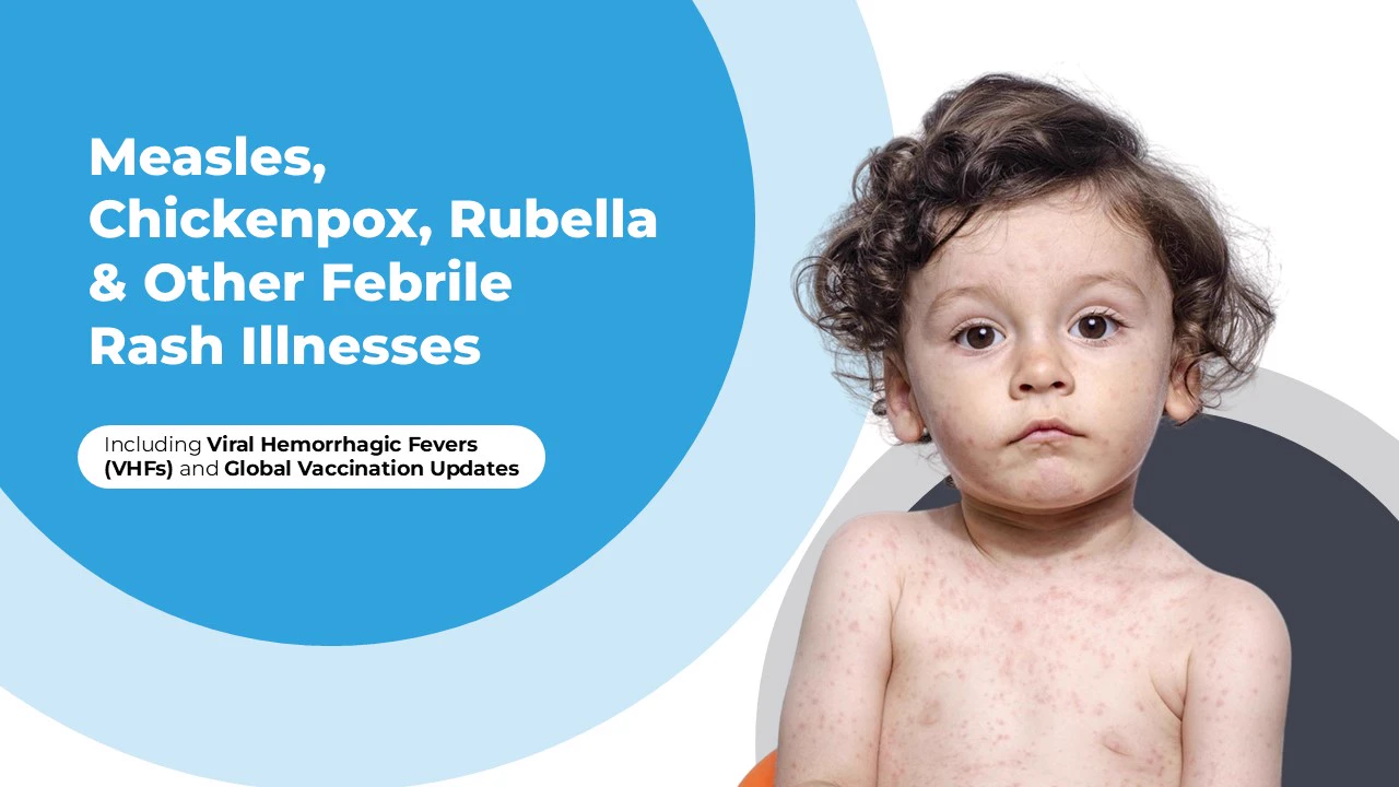 Measles & Rubella